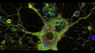 Glial cells and neurological disease research [upl. by Aristotle]