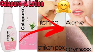 Calapure A Lotion Uses  Calamine Lotion  Review in English [upl. by Temhem721]