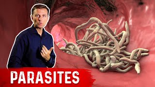 The Best Herbs for Parasites [upl. by Ori]