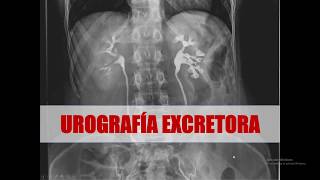 UROGRAFIA EXCRETORA FISIOLOGIA Y REALIZACION [upl. by Dayiz]