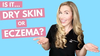 Is it Dry Skin or Eczema  How to Treat With Affordable Product Recommendations [upl. by Ycrad]