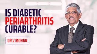 Is diabetic periarthritis curable  Dr V Mohan [upl. by Nossah]