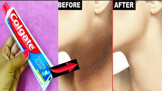 How to get rid dark neck in a few minutes  Toothpaste neck cleaning  neck black remove tips [upl. by Issac]