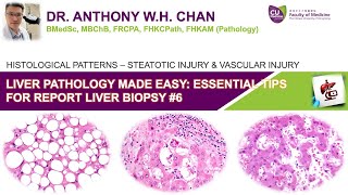 Liver Pathology Made Easy 67  Essential Tips for Reporting Medical Liver Biopsy [upl. by Kram]