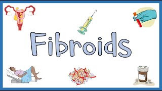 Uterine Fibroids  Types Causes Risk Factors Signs amp Symptoms Diagnosis amp Treatment [upl. by Andrien]