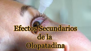 Efectos Secundarios de la Olopatadina [upl. by Oibesue]