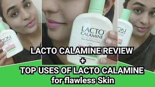 LACTO CALAMINE LOTION REVIEW AND USES [upl. by Algernon]