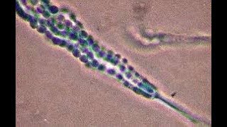 Penicillium cheresanum showing single celled conidia [upl. by Ahsatal]