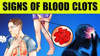 TOP 9 Warning SIGNS of BLOOD CLOTS  Bestie Foods [upl. by Rebliw]