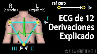 ECG de 12 Derivaciones Explicado Animación Alila Medical Media Español [upl. by Gneh]