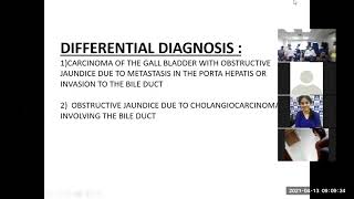 Case Presentation  Obstructive Jaundice 13042021 [upl. by Leal]