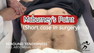 Mcburneys point । Appendicitis । Surgery short case । MBBS Final prof [upl. by Coreen71]