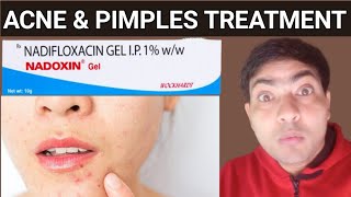 Nadoxin gel use in hindi nadoxin cream review acne treatment [upl. by Traver118]