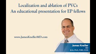 Localization and ablation of PVCsAn educational presentation for EP fellows [upl. by Elleval]