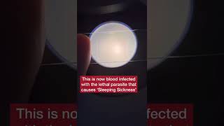 Malaria Parasite MP Microscope Test [upl. by Aksoyn578]