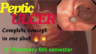 Peptic ulcer complete pharmacology  Bpharma  nursing  mbbs pharmacy pharmacology pepticulcer [upl. by Aihsenak561]