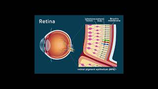 Angioid Streaks  Symptoms and Causes  Diagnosis  Management and Treatment  Prevention health [upl. by Larkins]