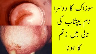 Gonorrhea Full Treatment  By Professor Hakeem Rana [upl. by Max530]