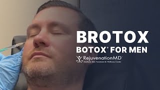 Botox for Men Treat Crow’s Feet Glabella and Forehead [upl. by Quarta]