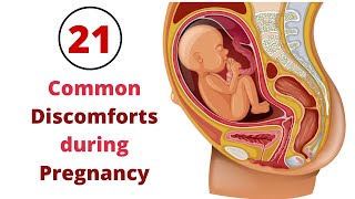 Relieve Discomfort  Numb amp swollen hands in Pregnancy FabMoms tips [upl. by Seigler]