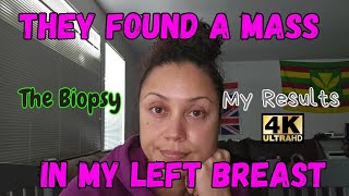 They Found A Mass In My Left Breast  My Biopsy  The Results  Biopsy Mammogram BreastHealth [upl. by Siurad800]