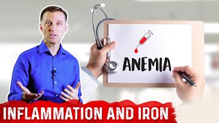 Why Chronic Inflammation Causes Anemia Iron Deficiency – Anemia of Chronic Disease – DrBerg [upl. by Ykvir]