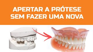 Saiba como apertar sua prótese dentária SEM PRECISAR TROCAR [upl. by Jehius]