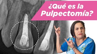 Pulpectomía ¿Qué es ¿Cuándo se debe hacer [upl. by Ennirok]