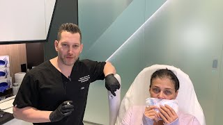 Female Facial Sculpting with Belotero  Smokers Lines and Lip Rejuvenation  West Hollywood CA [upl. by Acnaiv]