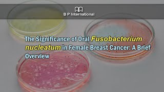 The Significance of Oral Fusobacterium nucleatum in Female Breast Cancer A Brief Overview [upl. by Namaj644]