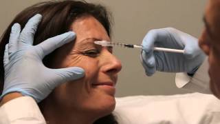 Crows Feet botulinum toxin injection training [upl. by Mellins91]