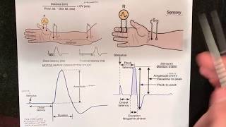 Nerve Conduction Studies NCV Fundamentals [upl. by Mcdonald]