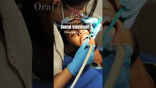 Dental treatmentdental caretooth brushtooth cleaningcavity shortsfeed trending treatment dr [upl. by Nerhtak]