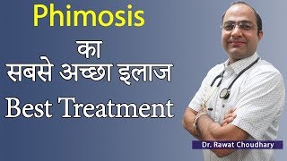 Phimosis का बिना ऑपरेशन के इलाज  Best Treatment of Phimosis  Best Homeopathic Doctor in India [upl. by Lindsay]