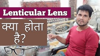 What Is Lenticular Lens  High Myopia Minus  1700 Shp  Eye Wear [upl. by Mehta]