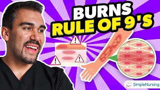 Burns Nursing Overview  Rule of Nines Types Causes Care [upl. by Cormier]