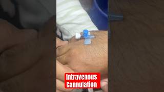 ivcannulation intravenous intravenouscannulation subscribe SMpharmacy follow rap [upl. by Annodam]