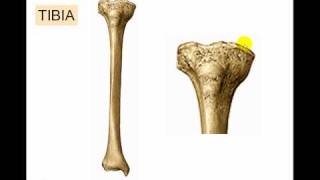 Tibia fracture Recovery  tibia recovery  tibia recovery injury implantation [upl. by Lion]