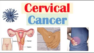 Cervical Cancer Risk Factors Pathophysiology Symptoms Staging Diagnosis Treatment amp Prevention [upl. by Eillen808]