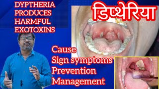 DIPTHERIA डिप्थेरिया बैक्टीरिया में जानलेवा EXOTOXINS infectiousdisease [upl. by Otrebmuh]