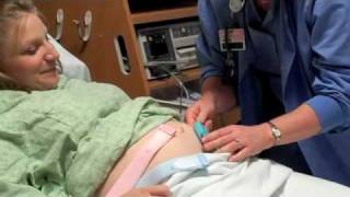 Maternity Fetal Monitoring [upl. by Furey]