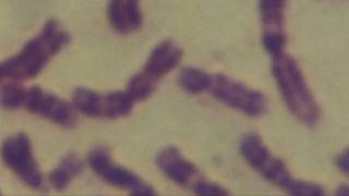 Cytogenetics Human chromosomes Karyotype [upl. by Laitselec741]