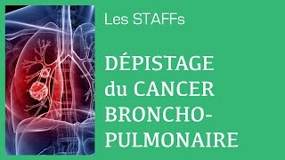 Cancer bronchopulmonaire Dépistage  04  STAFFs Saint Camille [upl. by Annice]