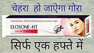 Elosone HT Cream Review Side Effects UsesBest Fairness Cream For Marks [upl. by Aninaig]