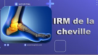 IRM de la cheville Bonne Pratique [upl. by Yacano]