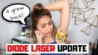 DIODE LASER HAIR REMOVAL UPDATE  AFFORDABLE Underarm Laser Hair Removal  Lolly Isabel [upl. by Hpejsoj]