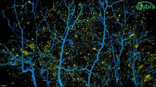 Adipose vasculature and inflammation [upl. by Belshin]