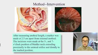 149 Is transurethral bladder outlet surgery useful for women with detrusor underactivity [upl. by Ynaffi67]