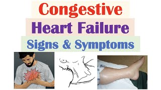 Congestive Heart Failure Signs amp Symptoms amp Why They Occur [upl. by Niloc537]