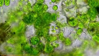 Coleochaete Algae and Zoospores microscopy [upl. by Lertsek]